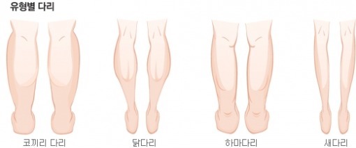 퉁퉁 부은 무다리 탈출법 꿀팁 | 인스티즈