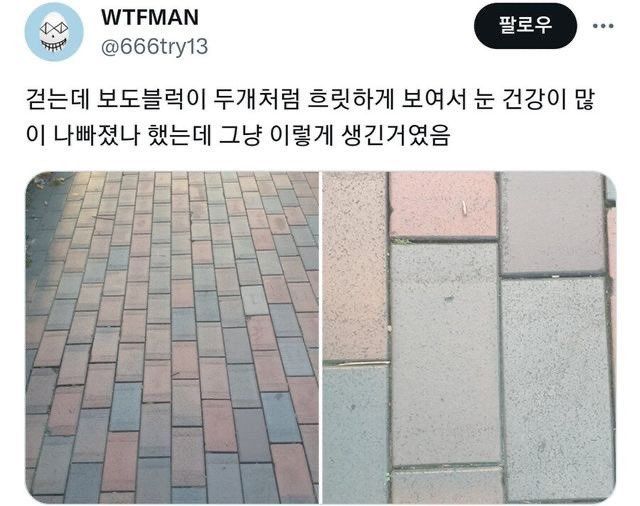 나는 내 눈이 나빠진 건가 했는데 | 인스티즈