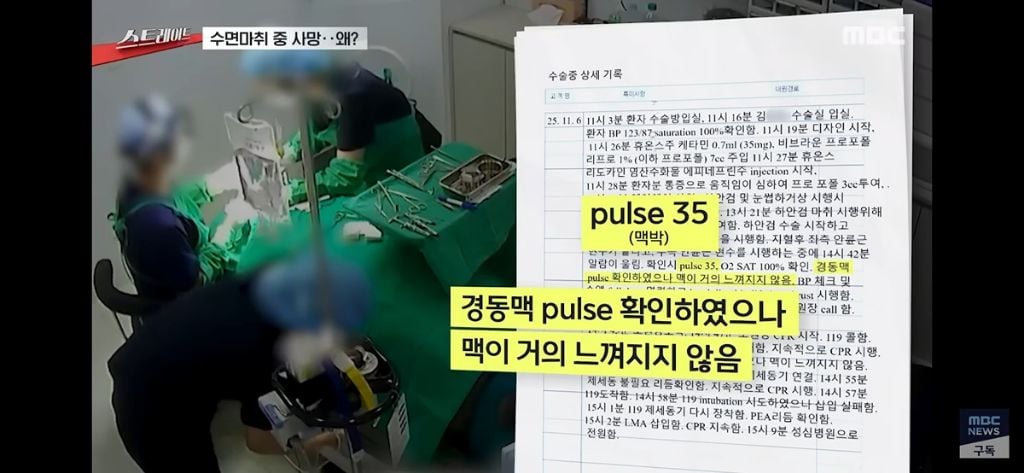 성형외과에서 상안검 하안검 수술 받다가 저산소성 뇌손상으로 사망..jpg | 인스티즈