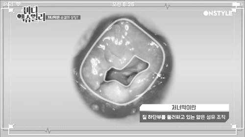 질막(처녀막)에 대해 넌 어디까지 알고있니? | 인스티즈