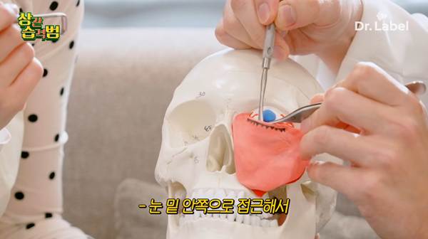 요즘 나이 있는 사람들이 한다는 수술.jpg | 인스티즈