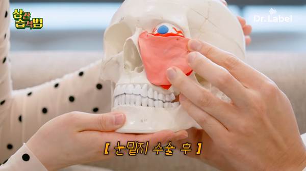 요즘 나이 있는 사람들이 한다는 수술.jpg | 인스티즈