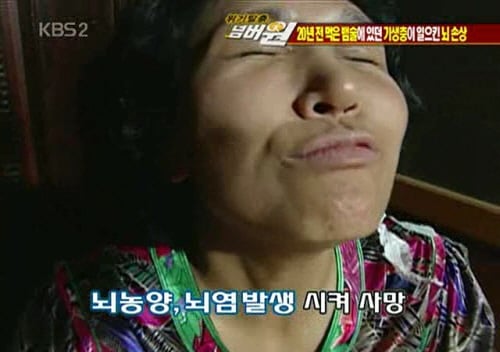 뱀술 마신 뒤로 2주째 비슷한 꿈을 꿉니다 | 인스티즈