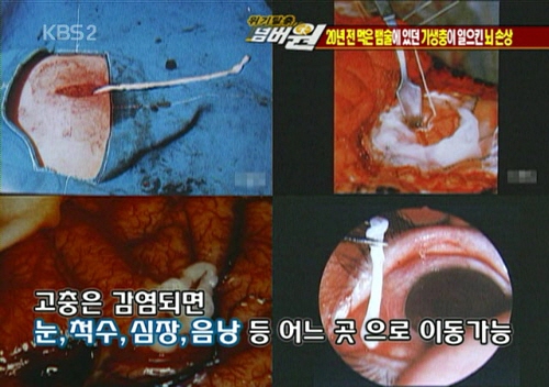 뱀술 마신 뒤로 2주째 비슷한 꿈을 꿉니다 | 인스티즈