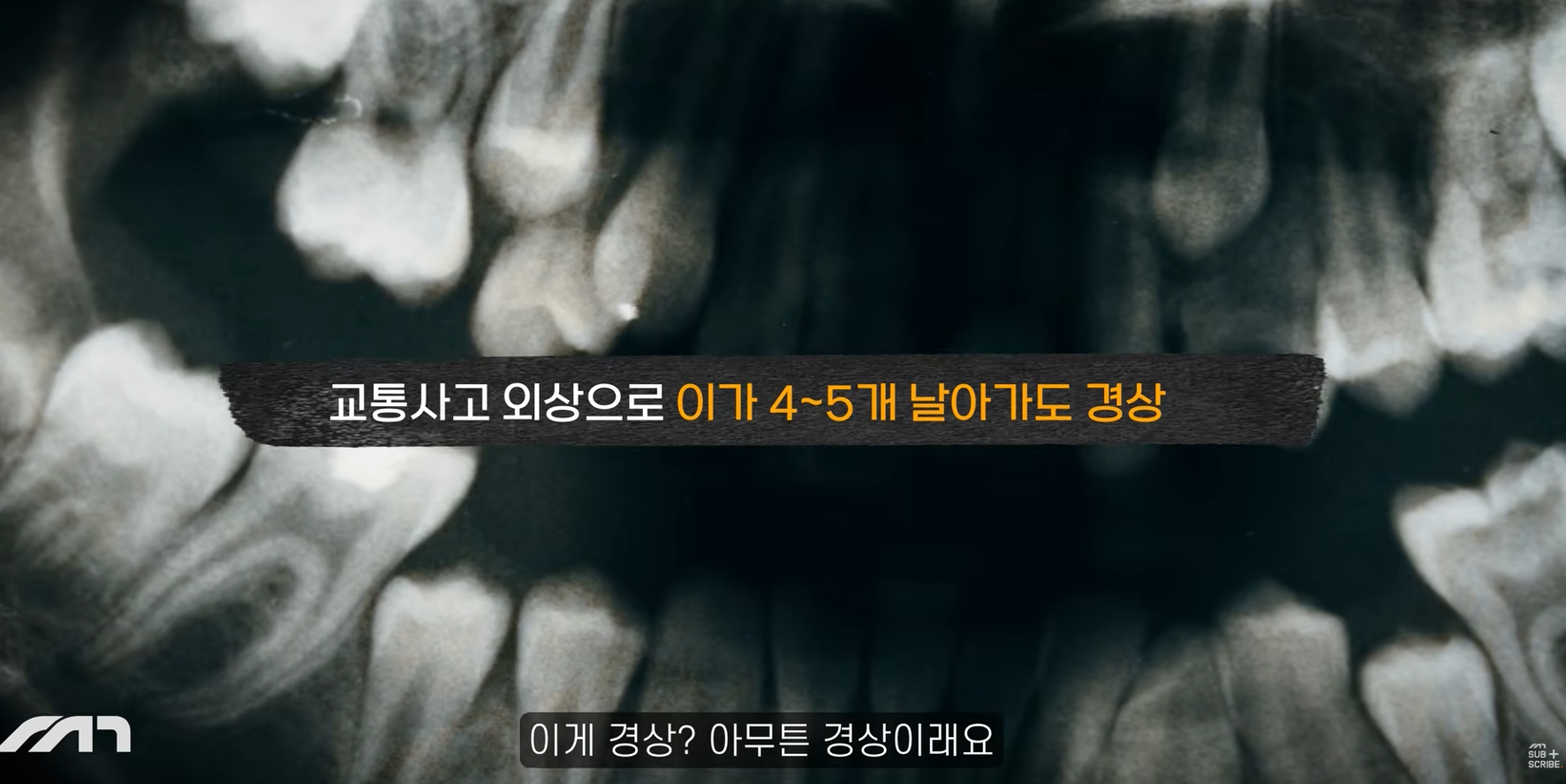 국토부가 자동차보험사랑 손잡고 개악하려는 중대사안 | 인스티즈