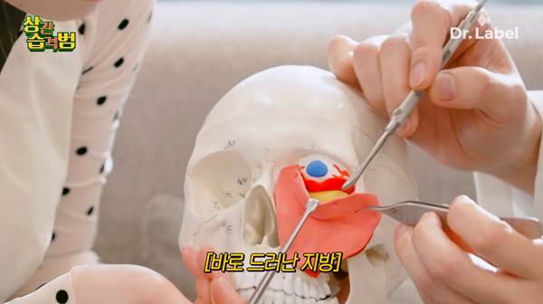 요즘 나이 있는 사람들이 한다는 수술.jpg | 인스티즈