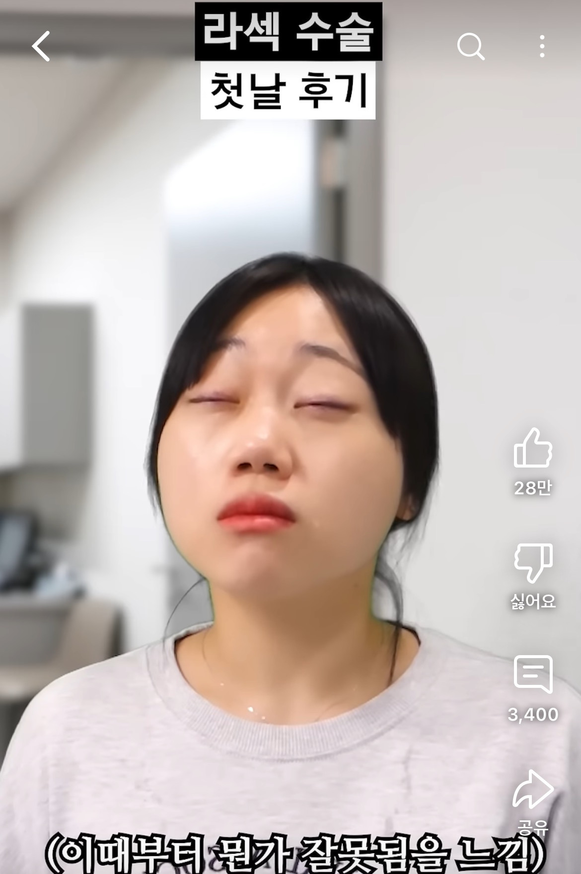 라섹 수술 후기 공감 100000%인 영상 | 인스티즈