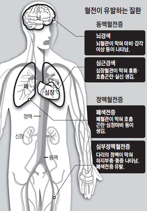 미세먼지가 위험한 진짜 이유 | 인스티즈