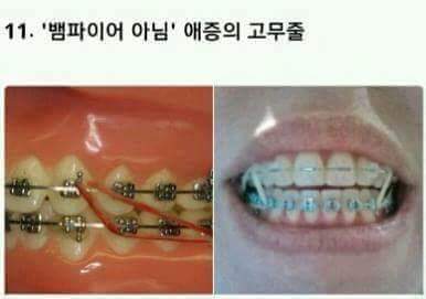 교정한 사람들은 공감하는것 | 인스티즈