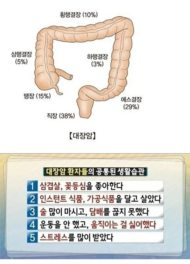 대장암 환자들의 공통된 생활습관 | 인스티즈