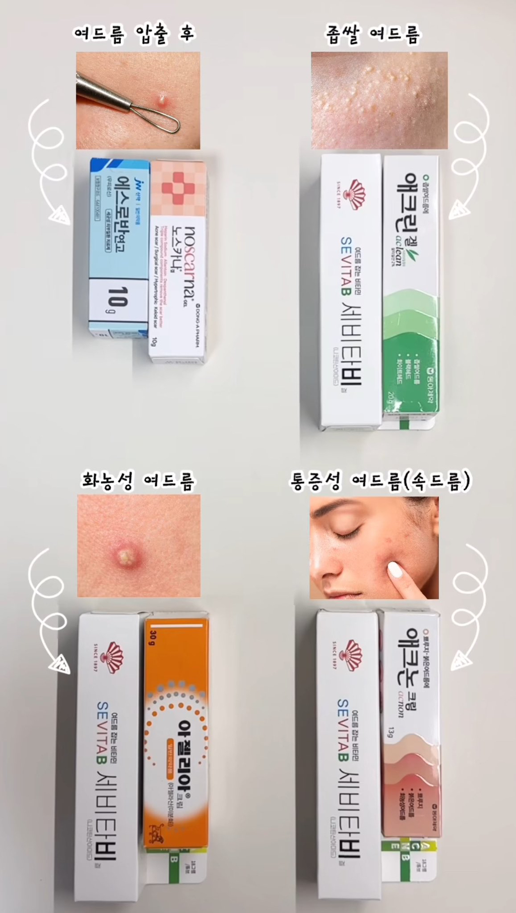 여드름 약국템 앙딱정 | 인스티즈
