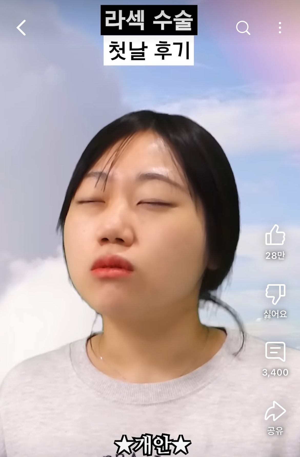 라섹 수술 후기 공감 100000%인 영상 | 인스티즈
