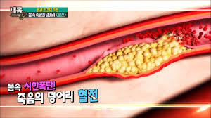미세먼지가 위험한 진짜 이유 | 인스티즈