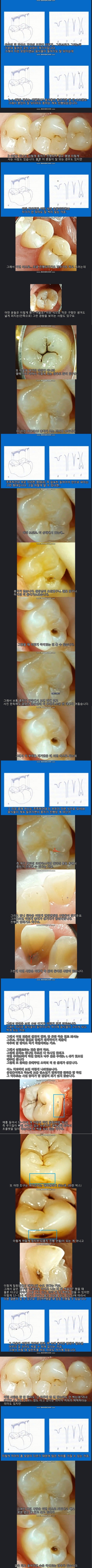치아는 타고나는 것이다.jpg | 인스티즈