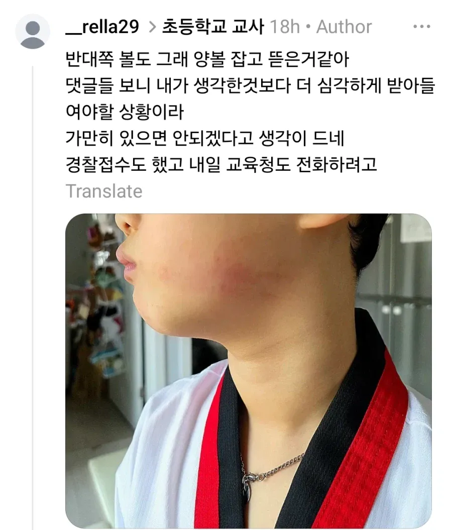 초1 학생 훈육한다고 볼 꼬집은 교사 | 인스티즈