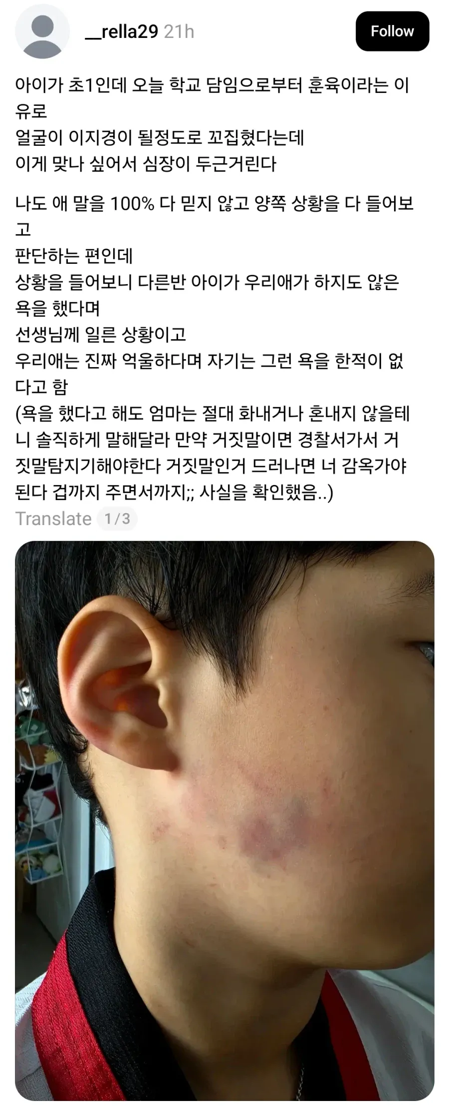 초1 학생 훈육한다고 볼 꼬집은 교사 | 인스티즈