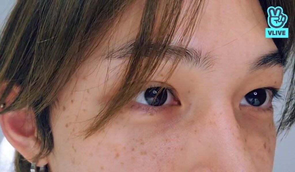 과거 주근깨 때문에 너무 힘들었다던 아이돌 | 인스티즈