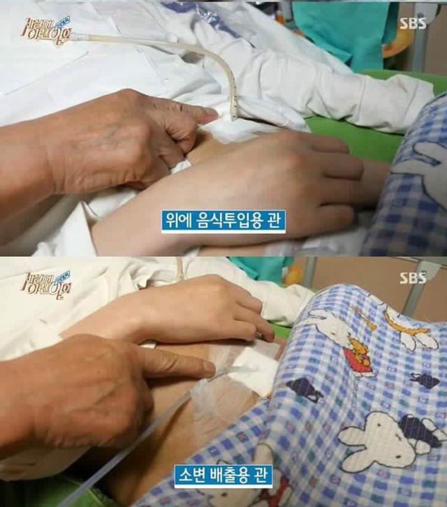 치매 아내와 식물인간 아들을 돌보는 할아버지.. | 인스티즈