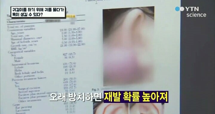 귀걸이하려다 수술까지.jpg (사진주의) | 인스티즈