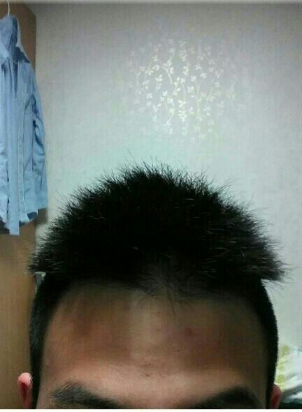 투블럭 헤어스타일 실패사례들.jpg | 인스티즈