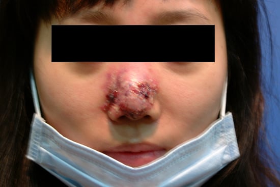 성형외과 종사자들이 말하는 부작용 위험높은 수술 쓰리톱 (약혐주의) | 인스티즈