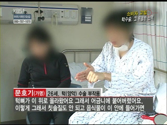 성형외과 종사자들이 말하는 부작용 위험높은 수술 쓰리톱 (약혐주의) | 인스티즈