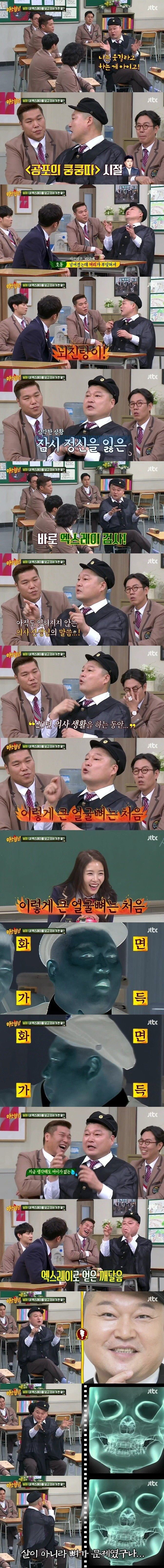 쿵쿵따 시절 뇌진탕으로 엑스레이 찍은 강호동 | 인스티즈