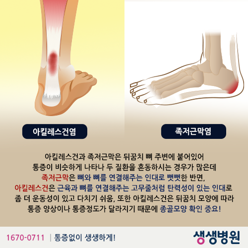 일상 정말 괴롭다는 발 병 투톱 | 인스티즈