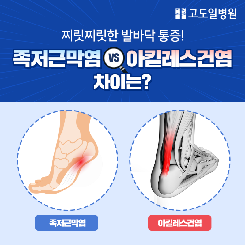 일상 정말 괴롭다는 발 병 투톱 | 인스티즈
