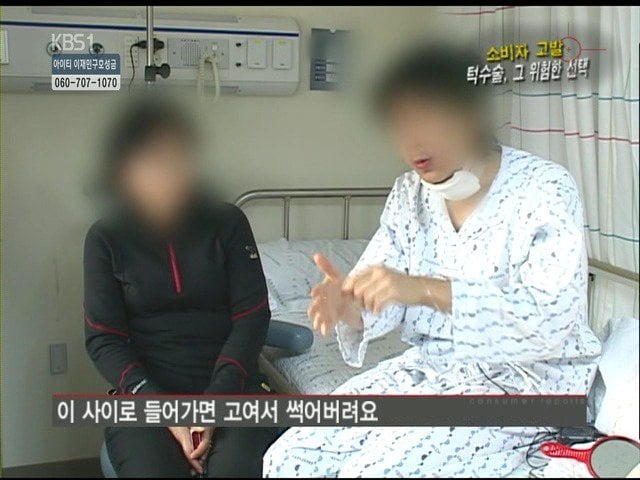 성형외과 종사자들이 말하는 부작용 위험높은 수술 쓰리톱 (약혐주의) | 인스티즈