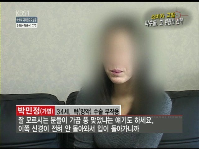 성형외과 종사자들이 말하는 부작용 위험높은 수술 쓰리톱 (약혐주의) | 인스티즈