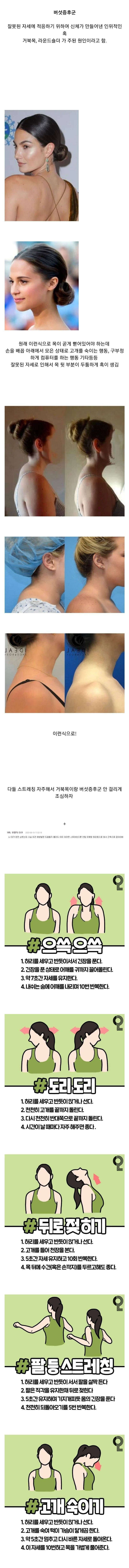 거북목 방치하면 생기는 증후군 | 인스티즈