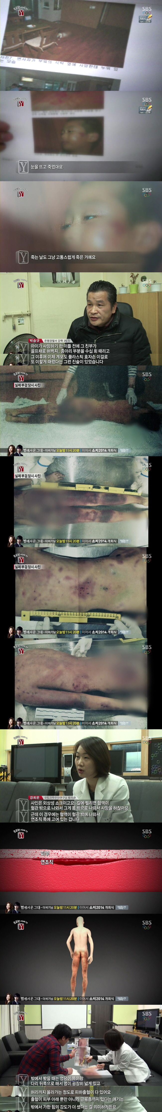 [궁금한이야기Y] 피멍으로 물든 채 세상 떠나 9살 건희.jpg | 인스티즈