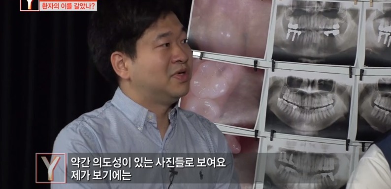 [궁금한이야기] 같은 치과 의사들도 충격받았다는 진료사진.jpg | 인스티즈