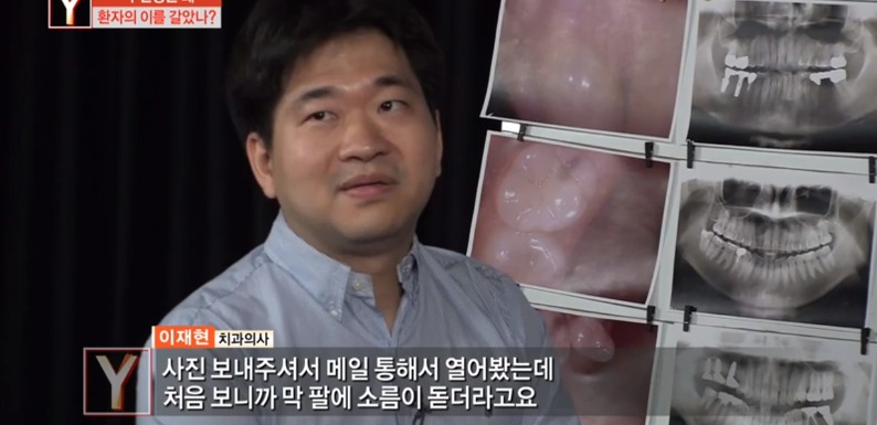 [궁금한이야기] 같은 치과 의사들도 충격받았다는 진료사진.jpg | 인스티즈