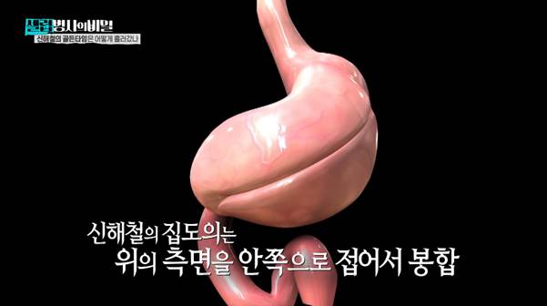 어제자 재조명 됐다는 신해철 죽음의 이유…jpg | 인스티즈