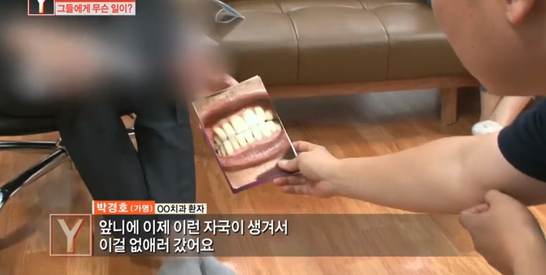 [궁금한이야기] 같은 치과 의사들도 충격받았다는 진료사진.jpg | 인스티즈