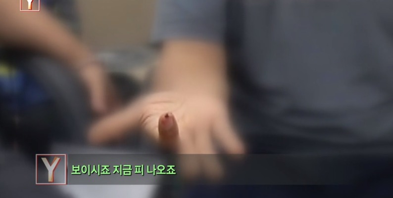 [궁금한이야기] 같은 치과 의사들도 충격받았다는 진료사진.jpg | 인스티즈