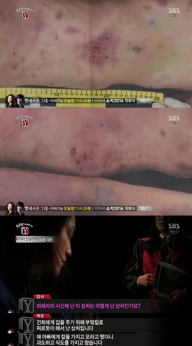 [궁금한이야기Y] 피멍으로 물든 채 세상 떠나 9살 건희.jpg | 인스티즈