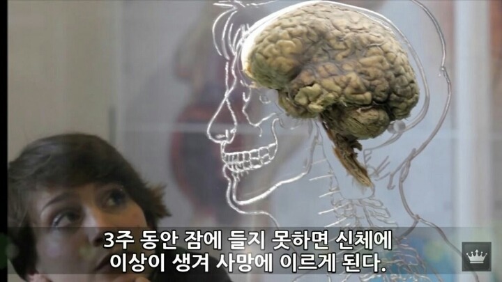 사람이 잠을 안자면 일어나는 현상 | 인스티즈