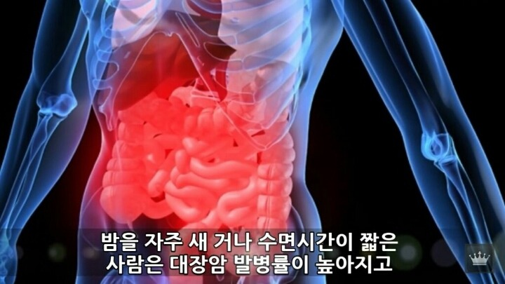 사람이 잠을 안자면 일어나는 현상 | 인스티즈