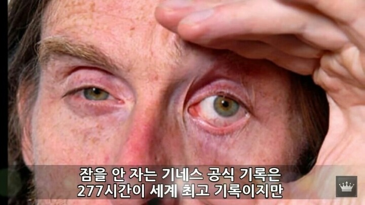 사람이 잠을 안자면 일어나는 현상 | 인스티즈