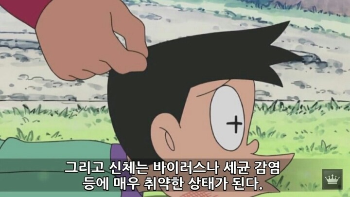 사람이 잠을 안자면 일어나는 현상 | 인스티즈