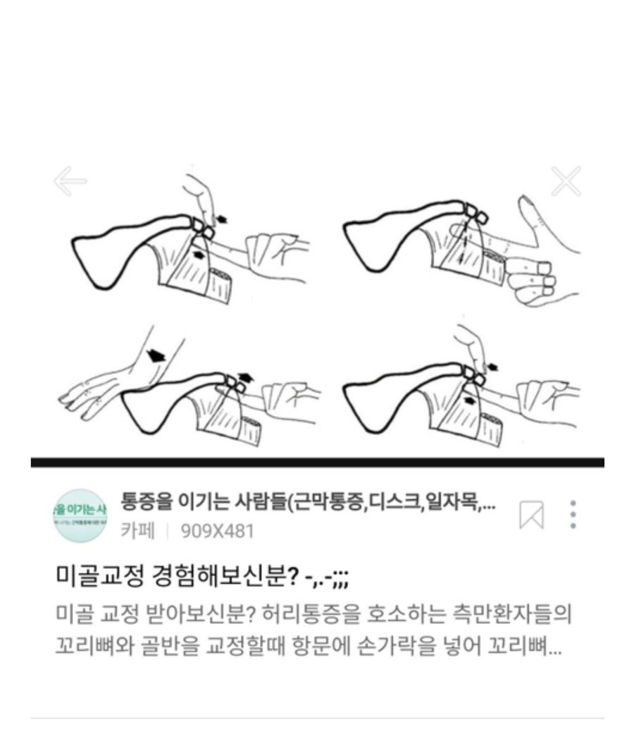 항문에 직접손을 넣어 척추교정하는 미골교정.jpg | 인스티즈
