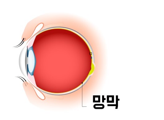 사진 파상풍 걸리는 이유 ㅋㅋㅋ | 인스티즈