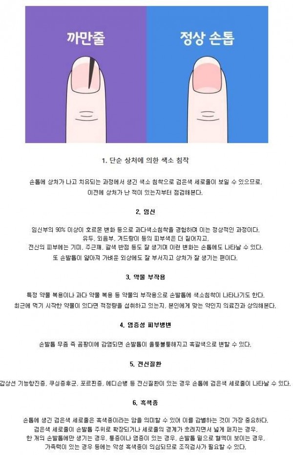 손톱에 검은색 세로줄이 생기는 이유 | 인스티즈