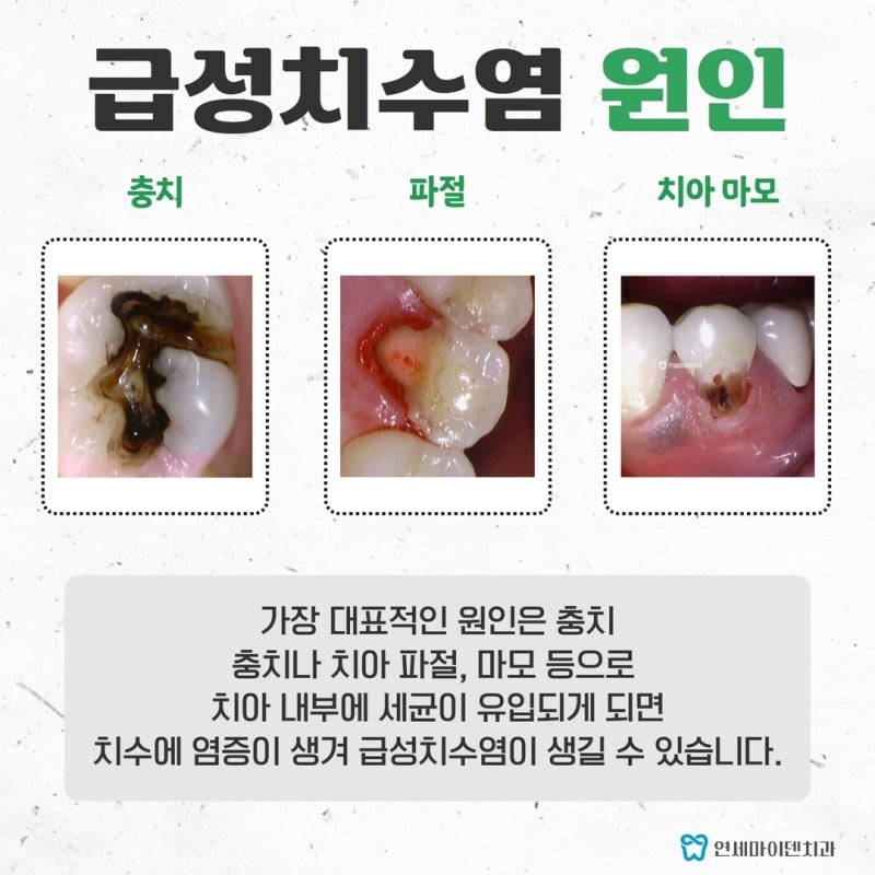 의학계 3대 통증.jpg | 인스티즈