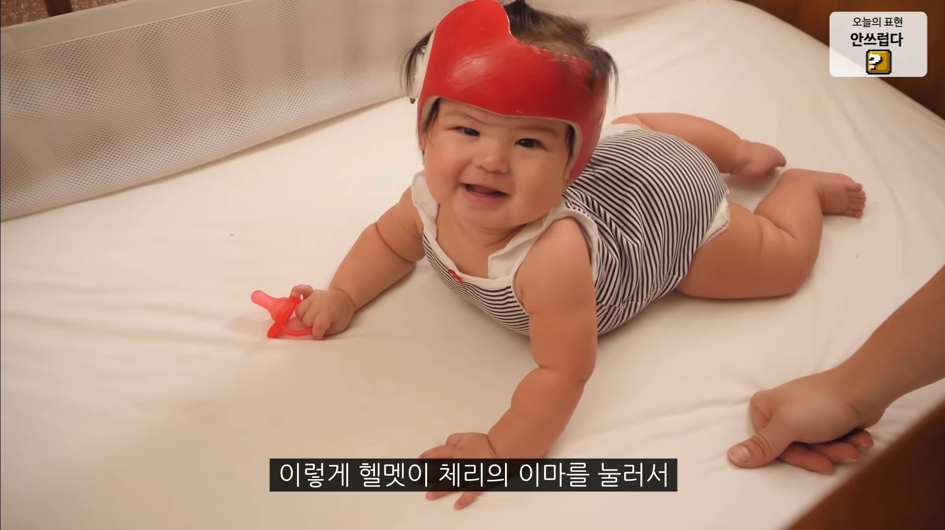 드디어 3개월만에 머리 교정 헬멧을 벗은 올리버쌤네 체리 🍒 | 인스티즈