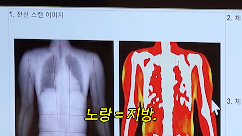 측정이 안되는 수준이라는 샤이니 민호 지방량 | 인스티즈