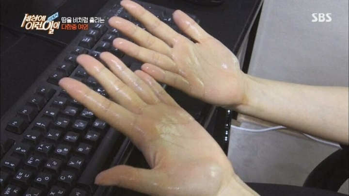 세상에 이런일이... 역대급 다한증 땀녀 | 인스티즈